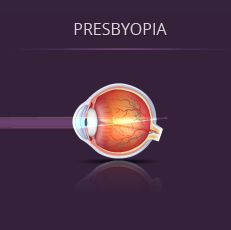 Presbyopia Diagram